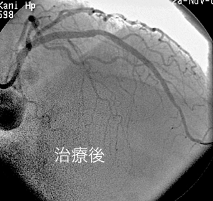 だんだん仕事が忙しくなってきました．_a0055913_23501870.gif