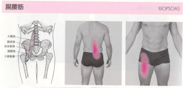 腸腰筋の筋筋膜性疼痛症候群（ＭＰＳ）②_b0052170_18303320.jpg