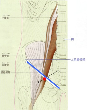 腸腰筋の筋筋膜性疼痛症候群（ＭＰＳ）②_b0052170_18442029.jpg