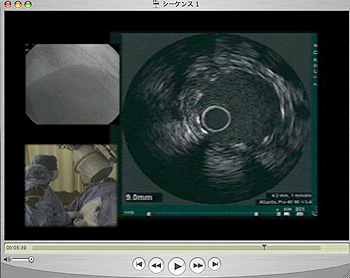 a0055913_03941.gif