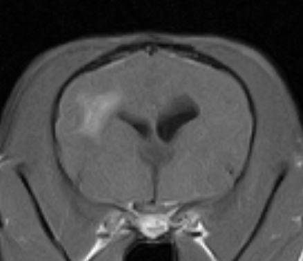 Granuromatous Meningoencephalitis2:GME（肉芽腫性髄膜脳炎）_c0032335_11413367.jpg