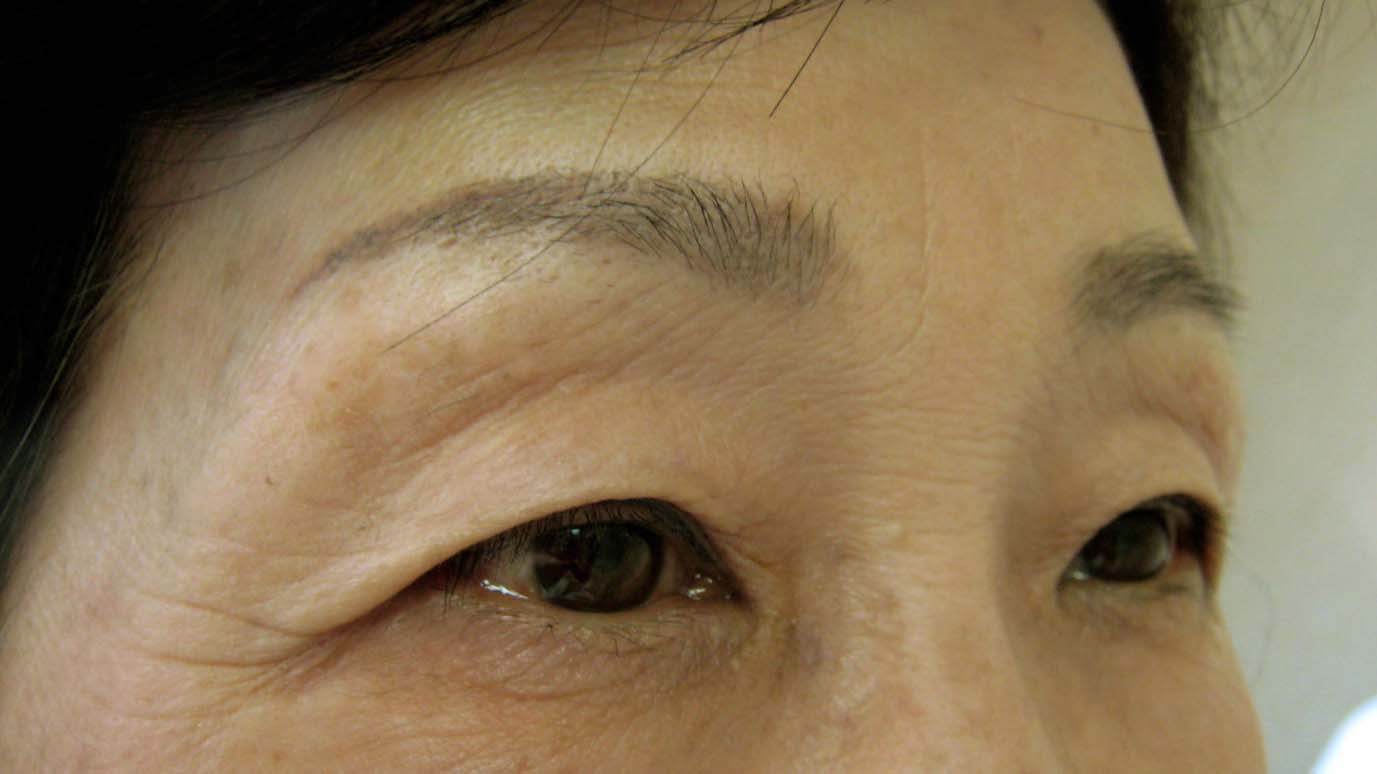 2回目の眉施術_c0124015_2034274.jpg