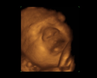f0023745_1451733.jpg