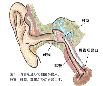 急性中耳炎のアニメーション_e0084756_189040.gif