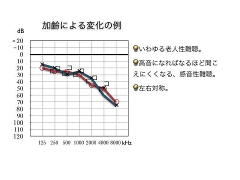 聴力検査〜その5〜_e0084756_16521688.gif