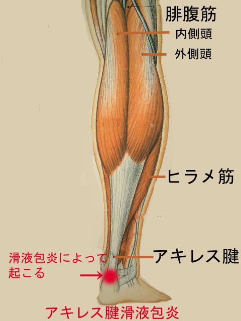 アキレス腱炎になったかも 左足がいたい 赤い巨塔の大学院生 関東で常勤研究者になる アキレス腱炎になったかも 左足がいたい 赤い巨塔の大学院生 関東で常勤研究者になる