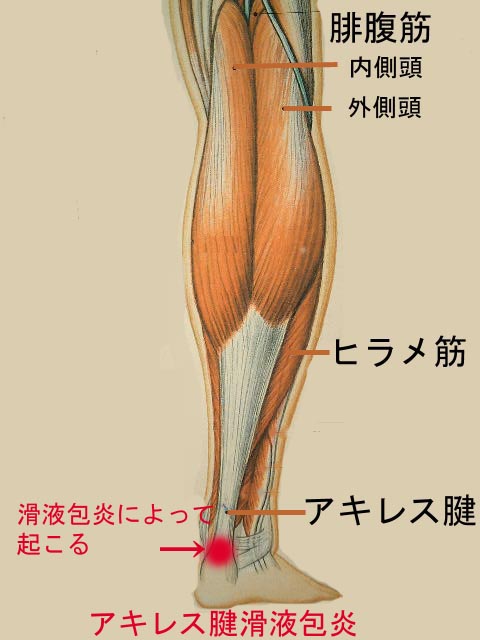 アキレス腱炎になったかも。左足がいたい。_c0103232_1513120.jpg