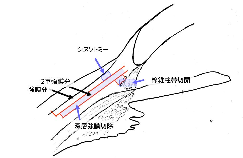f0088231_7274248.jpg