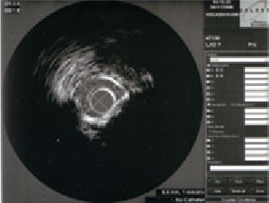 a0055913_02550.gif