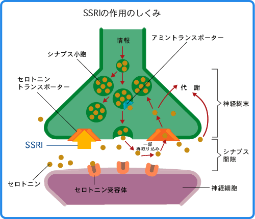 今日も元気か?プロザック_c0139575_21104381.gif