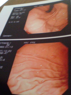 経鼻内視鏡も辛かった(;_;)_f0102471_10225636.jpg