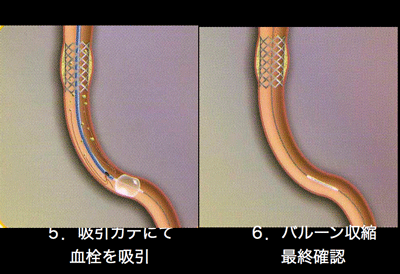 a0055913_8473547.gif