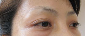 アートメイク　フルセット　初回_c0124015_0171227.jpg