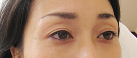 アートメイク　フルセット　初回_c0124015_1655505.jpg