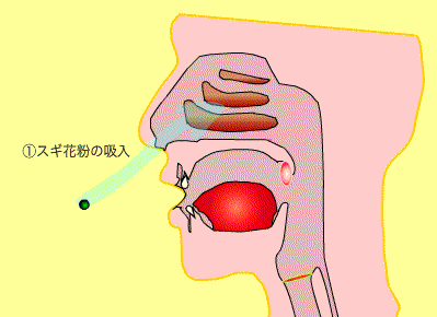 花粉症ムービー(感作の過程)_e0084756_12354187.gif