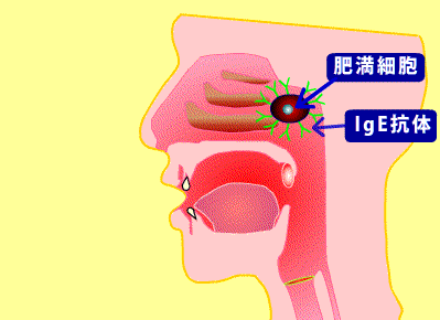 花粉症ムービー(花粉の再吸入)_e0084756_18411210.gif