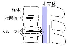 e0118224_15165818.gif