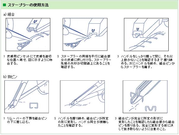その 尊敬する 騙す 医療 用 ホッチキス と は Fujisawa Style Jp その 尊敬する 騙す 医療 用 ホッチキス と は Fujisawa Style Jp
