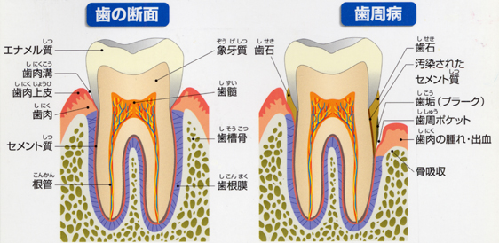 コラム・第５回 / Dr.工藤　諭 ［二期会歯科クリニック］　_c0130091_765618.jpg