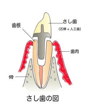 コラム・第５回 / Dr.工藤　諭 ［二期会歯科クリニック］　_c0130091_77853.jpg