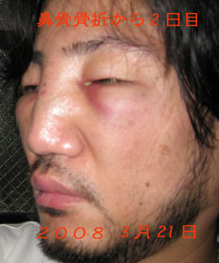 客に殴られました。~その後2~_a0019032_981731.jpg