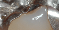 e0004468_188157.gif