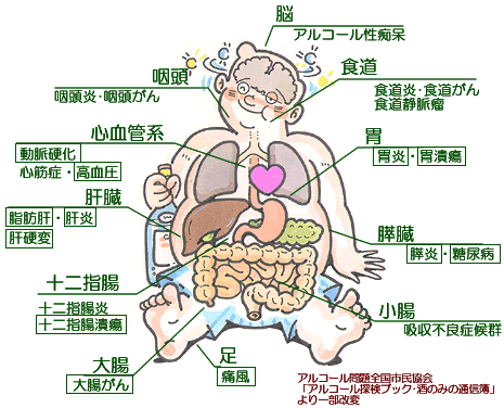 Oさんの胃がん_e0097212_18524944.gif