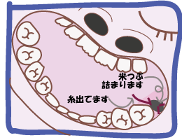 d0020828_13165137.gif