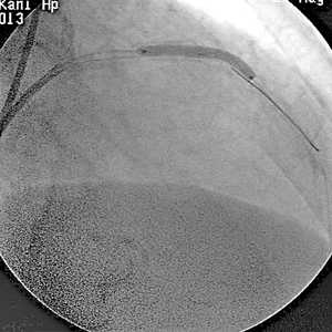 a0055913_041761.gif
