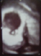 f0128278_18443839.jpg