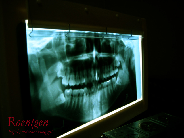 Roentgen_b0042500_2224518.jpg