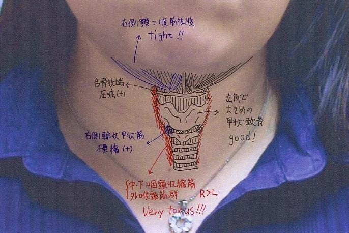 右反回神経麻痺が治った！　症例報告_e0146240_19391419.jpg