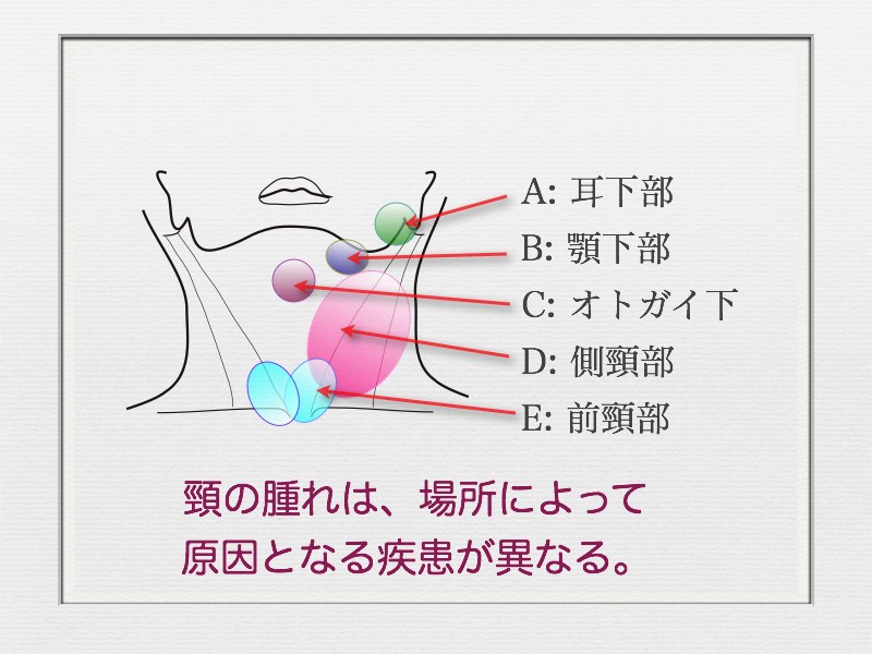 頸の腫れ〜部位別に考えられる疾患〜_e0084756_8125922.jpg