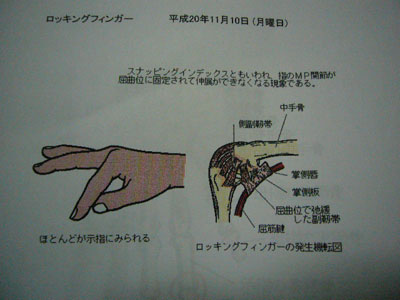 ロッキング・フィンガー_f0055024_3342982.jpg