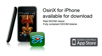 OsiriX for iPhoneーやっと登場しました！_a0055913_051315.gif