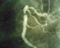 e0097212_14185446.gif