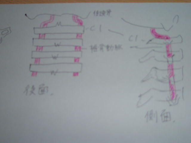 頭痛・片頭痛の原因と治療_d0047440_18561114.jpg