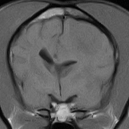 histiocytic sarcoma2（組織球肉腫2）_c0032335_13441532.jpg