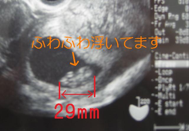 e0142283_2258272.jpg