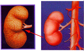 造影剤による腎障害に漢方治療を_a0055913_035223.gif