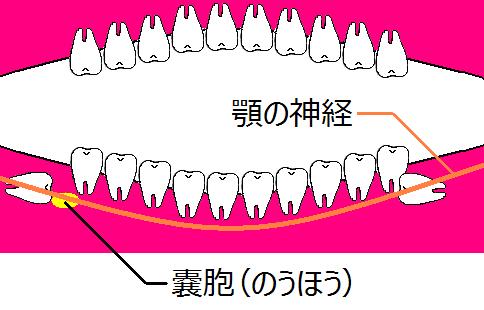 親知らずとの戦い 入院 手術編 前編 存在感のないページ