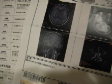 MRIの結果_a0091095_17581449.jpg