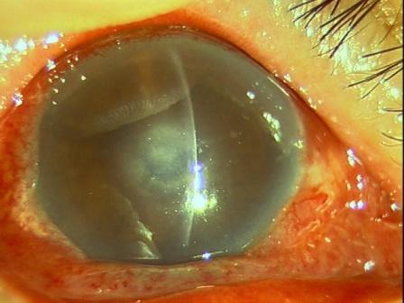 ドライアイセミナー その4 343 小さな眼科クリニック 城北公園 竹内眼科医院 ドライアイセミナー その4 343 小さな眼科クリニック 城北公園 竹内眼科医院