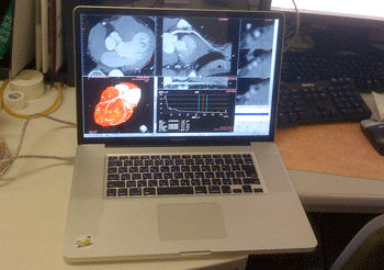 a0055913_0112476.gif