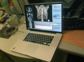 a0055913_085910.gif