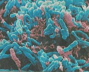 Mycobacterium xenopiの治療と予後について_e0156318_1314469.jpg