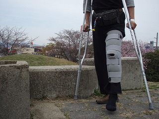松葉杖歩行 可動域訓練開始 術後６日 ７日 ｗａｌｋｉｎ ｕｐ