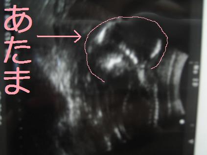 e0142283_23141864.jpg
