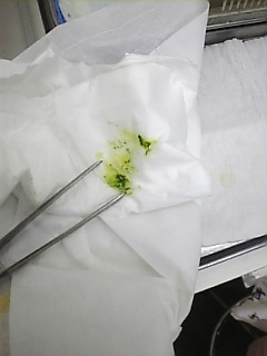 尿酸が黄色いのは・・・_c0049870_1514560.jpg