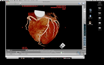 a0055913_064013.gif